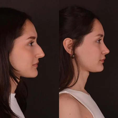 Plastic Surgery 01.jpg