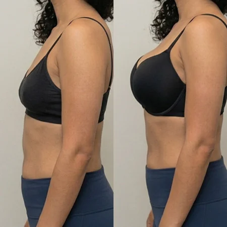 Plastic Surgery 02.jpg